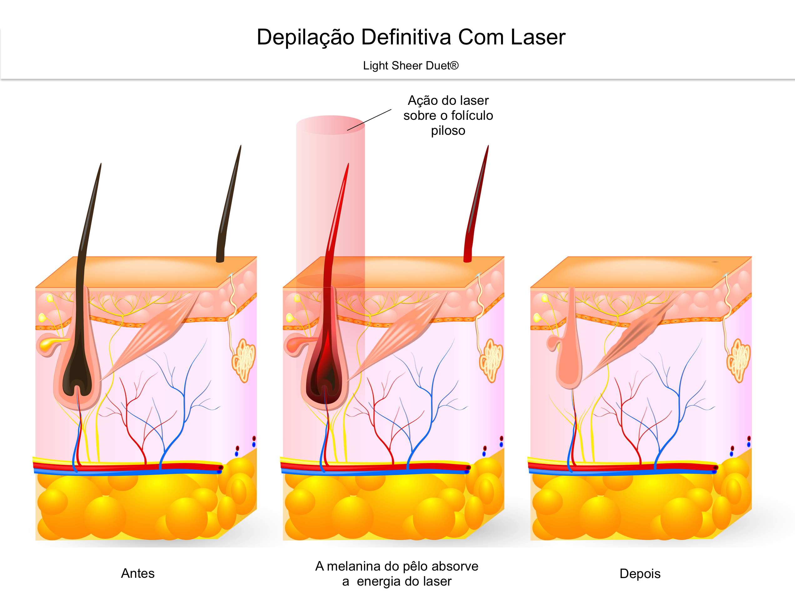 mistura-apelo-para-ser-atraente-momento-laser-diodo-antes-e-depois